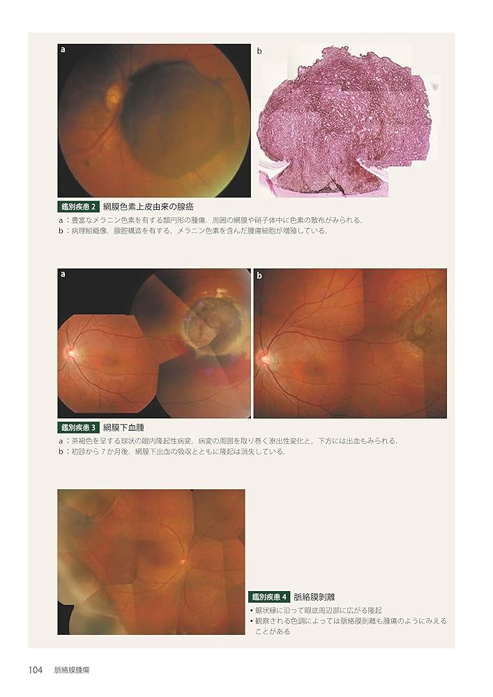 眼内腫瘍アトラス 裁断済み 商品詳細ページ | メディカルブックセンター